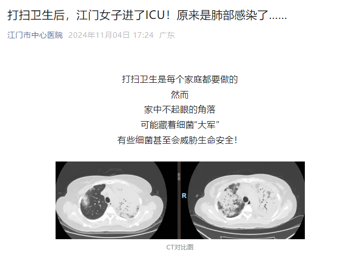 江门女子进了ICU！原来是打扫卫生后肺部感染了